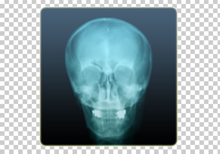 X-Ray Camera Girls Joke Android X-ray Vision PNG, Clipart, Android, App Store, Aptoide, Bone, Camera Free PNG Download