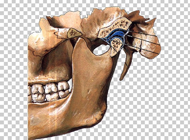 Temporomandibular Joint Mandible Articular Disk Anatomy PNG, Clipart, Anatomy, Articular Disk, Bone, Condyloid Process, Human Body Free PNG Download