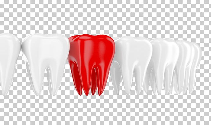 Tooth Red Dentistry White Mouth PNG, Clipart, Black White, Care, Compared, Dentist, Euclidean Vector Free PNG Download