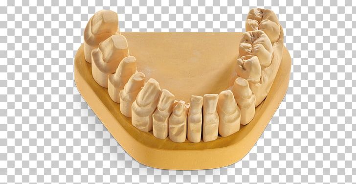Dental Laboratory Dentistry Dental Technician Dental Laser Saw PNG, Clipart, Concept, Cutting, Dental Laboratory, Dental Laser, Dental Technician Free PNG Download