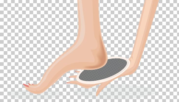 Finger Foot Skin Ulcer Calf PNG, Clipart, Ankle, Arm, Blister, Calf, Callus Free PNG Download