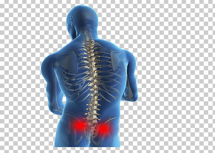 Low Back Pain Spinal Disc Herniation Therapy Human Back PNG, Clipart, Ache, Arm, Back, Back Injury, Back Pain Free PNG Download