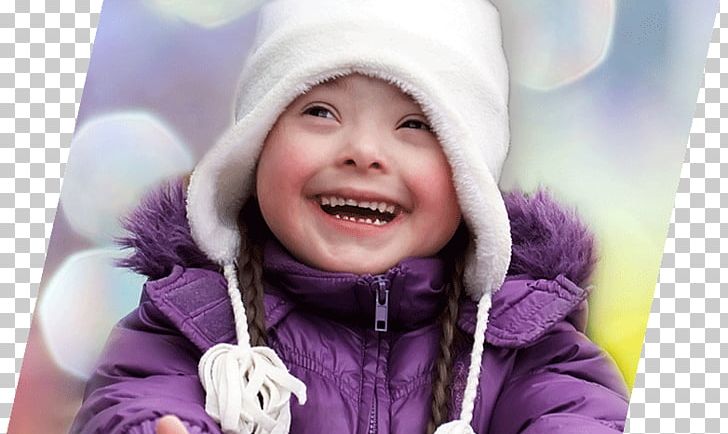 World Down Syndrome Day Child Photography PNG, Clipart, Child, Down Syndrome, Ear, Emotion, Facial Expression Free PNG Download