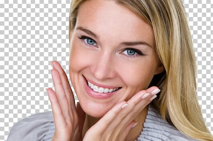 Dental Braces Dentistry Orthodontics Clear Aligners PNG, Clipart, Albert Klitzke Dds, All Smiles Dental, Beauty, Blond, Brown Hair Free PNG Download