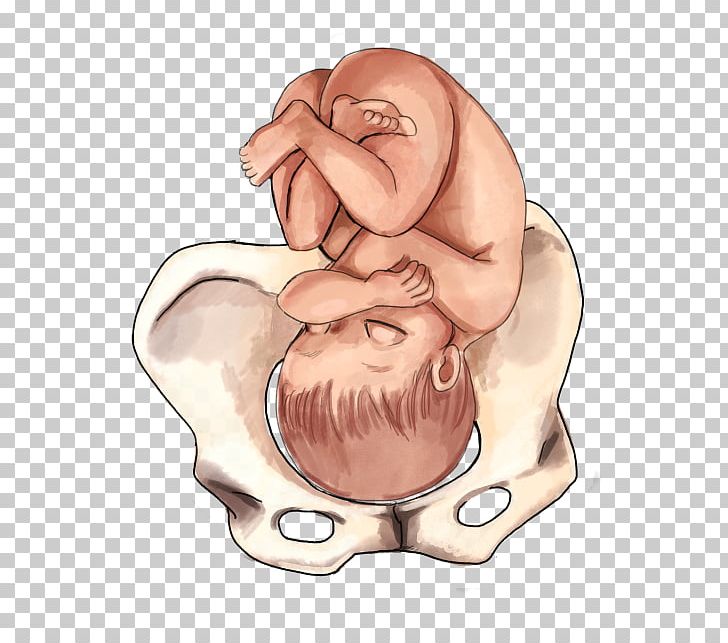 Fetal Position Childbirth Infant Presentation PNG, Clipart, Abdomen, Arm, Breech Birth, Cartoon, Cervix Free PNG Download