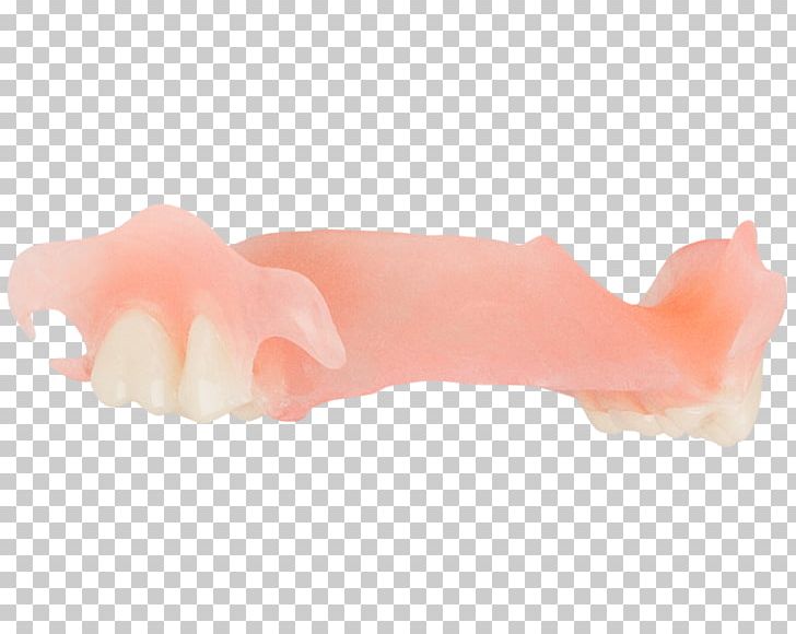 Dentures Dentistry Jaw 総義歯 Tooth PNG, Clipart, Art, Aspen, Aspen Dental, Auto Detailing, Dentistry Free PNG Download