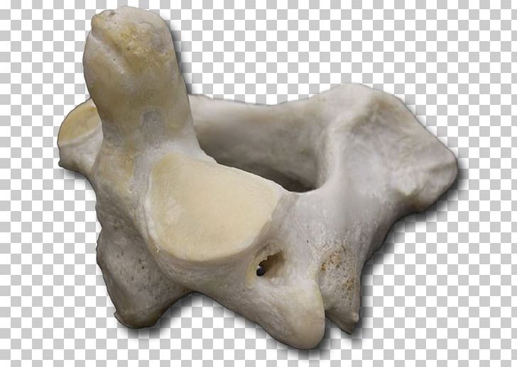 Bone Atlas Sculpture Vertebral Column VH Dissector PNG, Clipart, Anatomy, Artifact, Atlas, Bone, Carving Free PNG Download