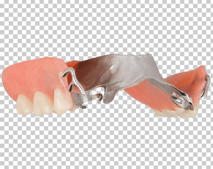 Thumb Shoe PNG, Clipart, Arrow, Aspen Dental, Cold, Finger, Hand Free PNG Download