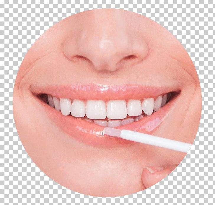 Frauen-Bundesliga Cosmetics Surgery Lip Mouth PNG, Clipart, Cheek, Chin, Closeup, Cosmetic Dentistry, Cosmetics Free PNG Download