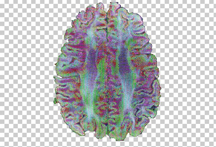 Brain Purple Medicine PNG, Clipart, Brain, Coral, Medical, Medicine, Organism Free PNG Download