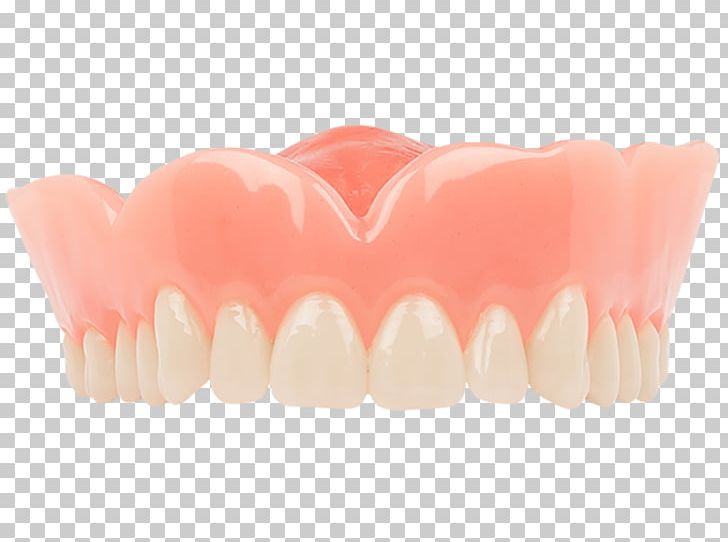Tooth Dentures Dentistry Aspen Dental PNG, Clipart, Aspen, Aspen Dental, Basic, Crown, Dental Free PNG Download