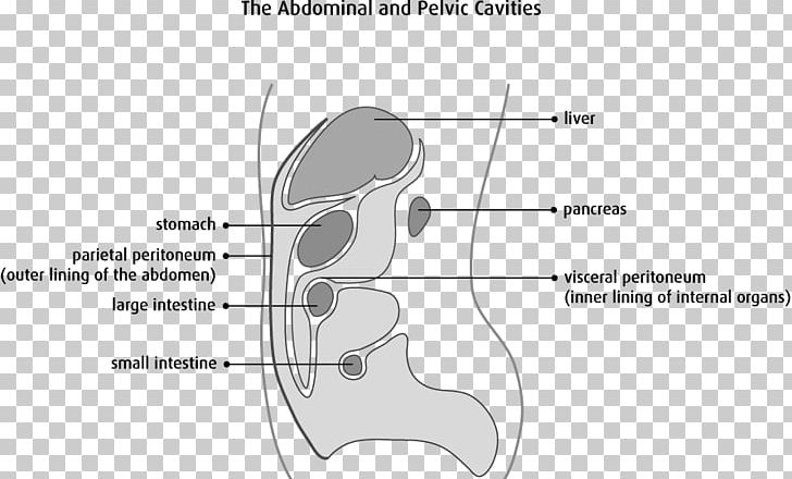 Peritoneum Peritoneal Mesothelioma Cancer Primary Peritoneal Carcinoma Mesothelium PNG, Clipart, Anatomy, Angle, Area, Ascites, Cancer Free PNG Download