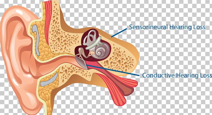 Ear Anatomy Middle Ear Outer Ear Inner Ear PNG, Clipart, Anatomy, Cross Section, Ear, Ear Anatomy, Ear Canal Free PNG Download