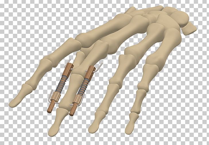 Finger PNG, Clipart, Adrian, Arm, Art, Dynamic, Finger Free PNG Download