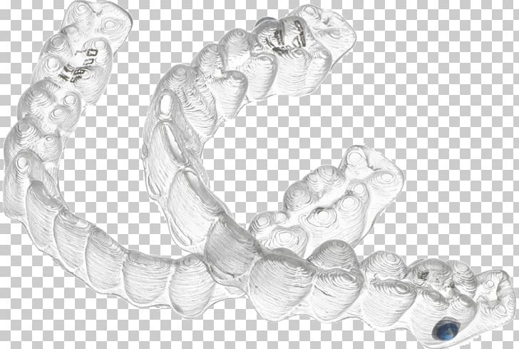 Clear Aligners Contemporary Orthodontics Dentistry Dental Braces PNG, Clipart, Black And White, Body Jewelry, Bracelet, Chain, Child Free PNG Download