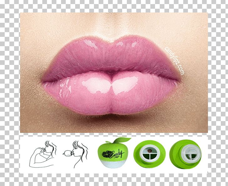 Lip Augmentation Cosmetics Beauty And The Peach Model PNG, Clipart, Antiaging Cream, Beauty, Beauty And The Peach, Cosmetics, Eyelash Free PNG Download