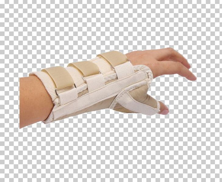 Thumb Wrist Brace Spica Splint PNG, Clipart, Arm, Bone Fracture, Carpal Tunnel Syndrome, Distal Radius Fracture, Finger Free PNG Download