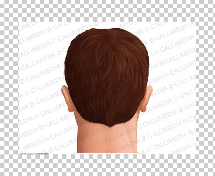 Head Anatomy Skin Hair Man Png Clipart Anatomi Anatomy Brown - hair capelli roblox free