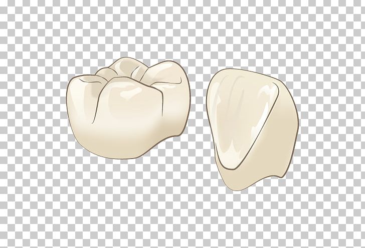 Dentistry Therapy 審美歯科 Tooth PNG, Clipart, Beige, Dental Implant, Dentist, Dentistry, Health Free PNG Download