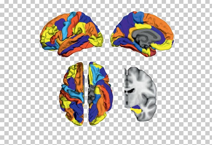 Amyloid Brain Soft Matter Alzheimer's Disease PNG, Clipart, Alzheimer, Alzheimers Disease, Amyloid, Brain, Cerebral Cortex Free PNG Download