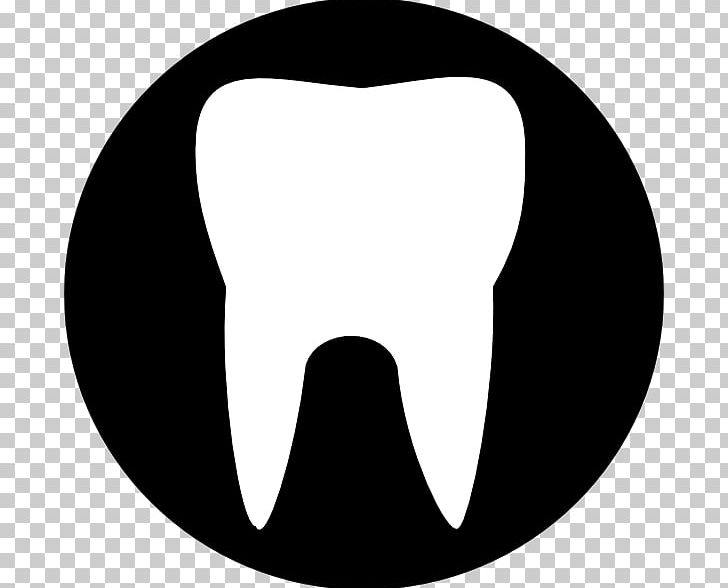 Human Tooth Molar PNG, Clipart, Angle, Black, Black And White, Circle, Clip Art Free PNG Download