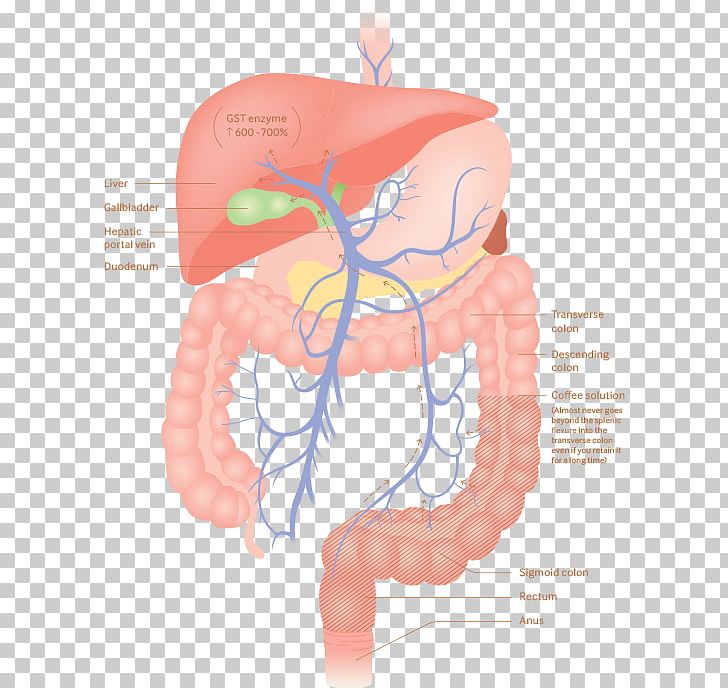 Coffee Enema Detoxification Gerson-Therapie PNG, Clipart, Abdomen, Alternative Health Services, Blood Vessel, Bowel, Brain Free PNG Download