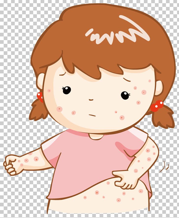 Miliaria Stock Photography Skin Rash PNG, Clipart, Blister, Boy, Cartoon, Cheek, Child Free PNG Download