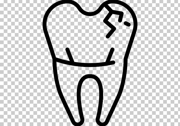 Dentistry Human Tooth Tooth Decay PNG, Clipart, Cosmetic Dentistry, Cracked Tooth Syndrome, Dental Extraction, Dental Implant, Dental Restoration Free PNG Download
