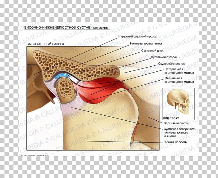 Temporomandibular Joint Dysfunction Anatomy Lateral Pterygoid Muscle PNG, Clipart, Anatomy, Articular Disk, Diagram, Ear, Fantasy Free PNG Download