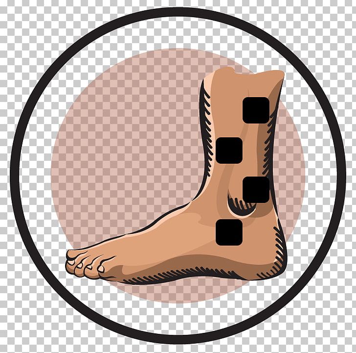 Transcutaneous Electrical Nerve Stimulation Foot Electrical Muscle Stimulation Electrode Ankle PNG, Clipart, Ankle, Carnivoran, Complex Regional Pain Syndrome, Dog Like Mammal, Ear Free PNG Download