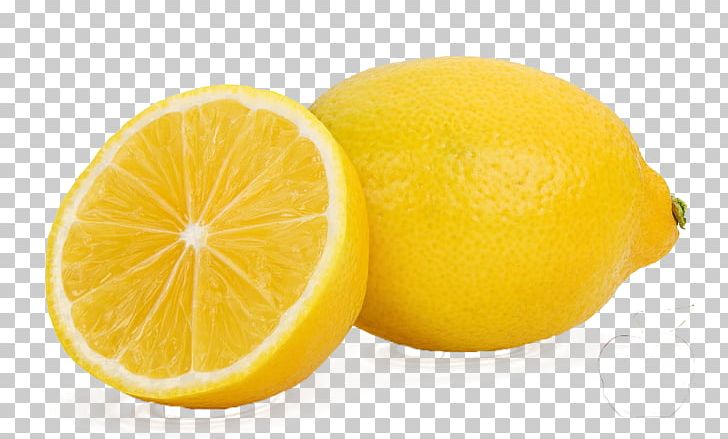 Lemon Juice Fruit Tree Seed PNG, Clipart, Business, Citric Acid, Citron, Citrus, Diet Food Free PNG Download