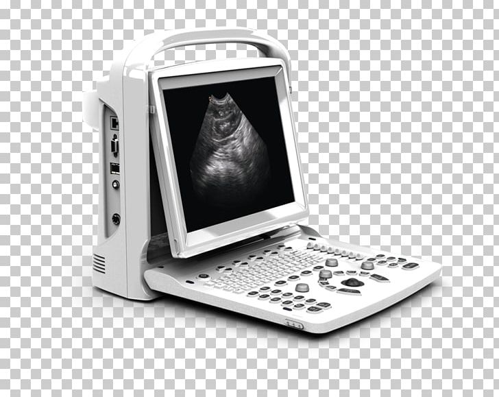 Ultrasonography Portable Ultrasound Doppler Echocardiography Medical Imaging PNG, Clipart, Ampronix, Doppler Ultrasonography, Electronic Device, Electronics, Health Technology Free PNG Download