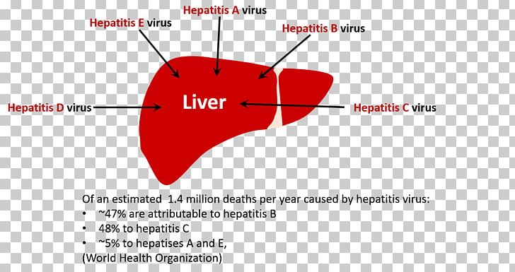 Viral Hepatitis Hepatitis A Hepatitis C Hepatitis D PNG, Clipart, Alcoholism, Angle, Brand, Circle, Coinfection Free PNG Download