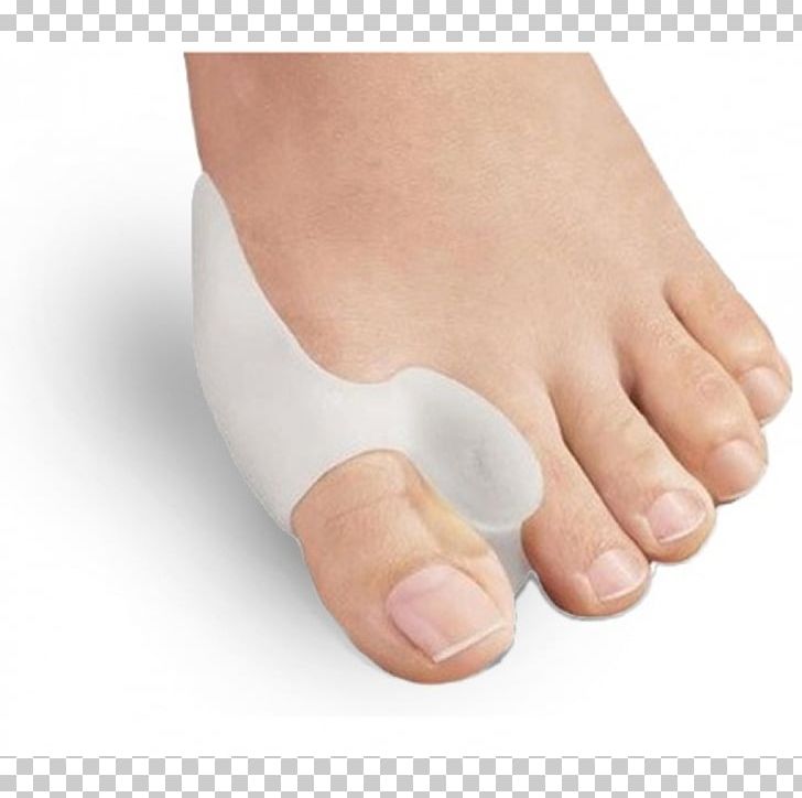 Tailor's Bunion Splint Toe Foot PNG, Clipart,  Free PNG Download
