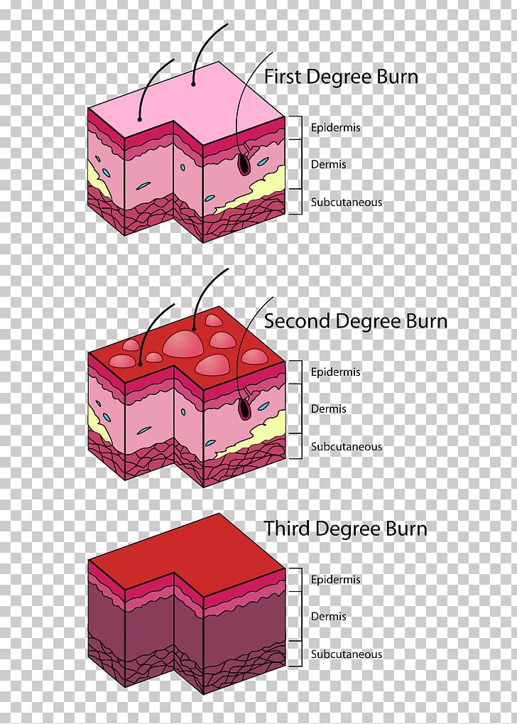 Burn Third Degree Vierdegraads Brandwond Eerstegraads Brandwond Blister PNG, Clipart, Academic Degree, Ache, Angle, Blister, Box Free PNG Download