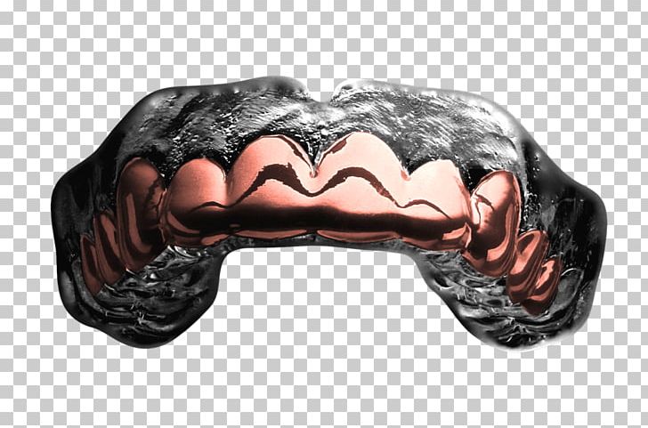 Mouthguard Grill Gold Jaw PNG, Clipart, American Football, Biting, Black Gold, Boxing, Dentist Free PNG Download