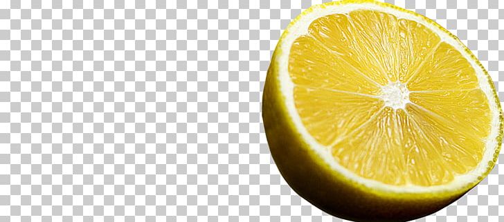 Lemon-lime Drink Citron Sweet Lemon PNG, Clipart, Citric Acid, Citron, Citrus, Food, Fruit Free PNG Download