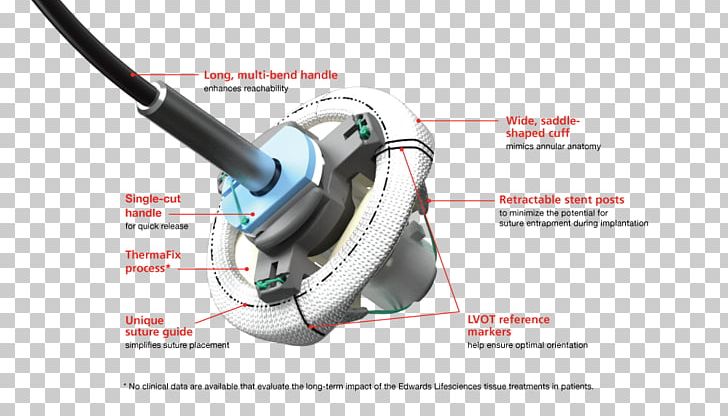 Aortic Valve Mitral Valve Pericardial Heart Valves PNG, Clipart, Aortic Valve, Aortic Valve Replacement, Audio, Audio Equipment, Edwards Lifesciences Free PNG Download