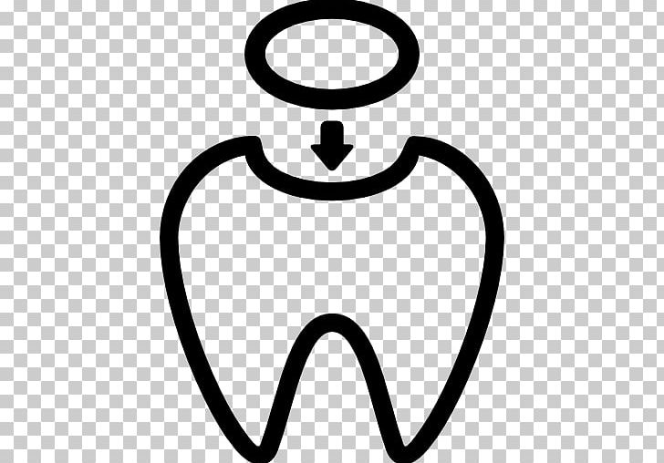 Dental Restoration Dentistry Human Tooth PNG, Clipart, Area, Black And White, Body Jewelry, Crown, Dental Free PNG Download