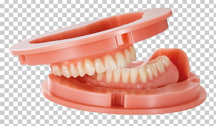 Tooth Dentures Dental Laboratory Dentistry PNG, Clipart, Abformung, Cadcam Dentistry, Crown, Dental, Dental Technician Free PNG Download