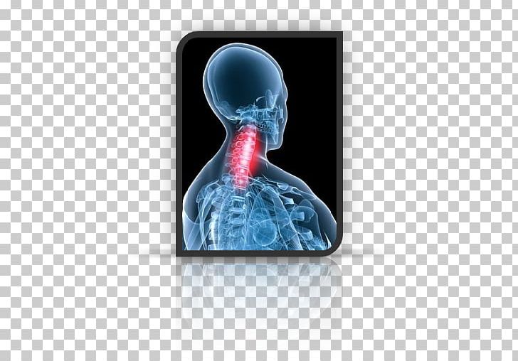 Neck Pain Riluzole Drug Osteochondrosis PNG, Clipart, Ache, Amyotrophic Lateral Sclerosis, Dard, Disease, Drug Free PNG Download