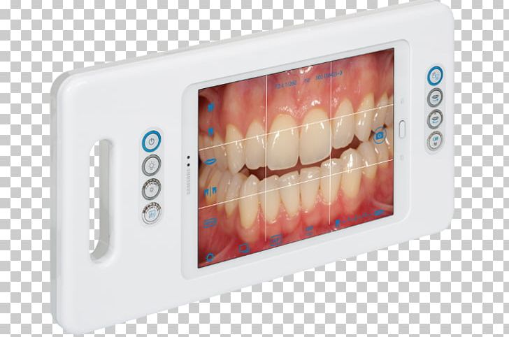 Dentistry Samsung Galaxy Tab S3 Camera Tooth PNG, Clipart, Camera, Cheek, Dentist, Dentistry, Electronic Device Free PNG Download