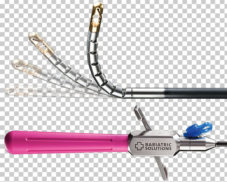 Bariatric Surgery Adjustable Gastric Band Trigger Finger Laparoscopy PNG, Clipart, Adjustable Gastric Band, Banding, Bariatrics, Bariatric Surgery, Finger Free PNG Download