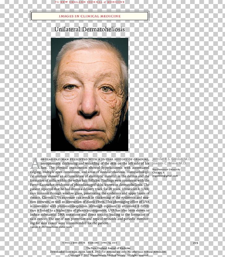 Photoaging Ultraviolet Skin Care Truck Driver PNG, Clipart, Ageing, Chin, Eyebrow, Face, Facial Free PNG Download