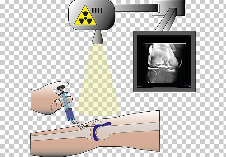Injection Radiology Arthrogram Computed Tomography Magnetic Resonance Imaging PNG, Clipart, Angle, Arm, Brain, Clinic, Computed Tomography Free PNG Download