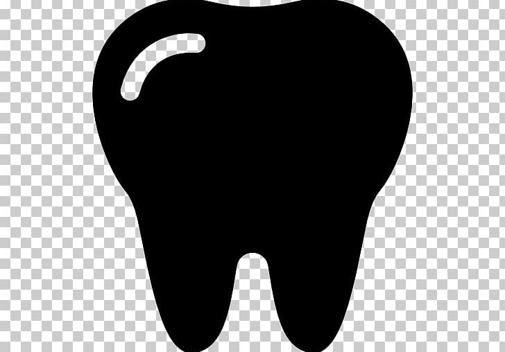 Human Tooth Dentin Hypersensitivity Angelet De Les Dents PNG, Clipart, Angelet De Les Dents, Black, Black And White, Computer Wallpaper, Dentin Hypersensitivity Free PNG Download