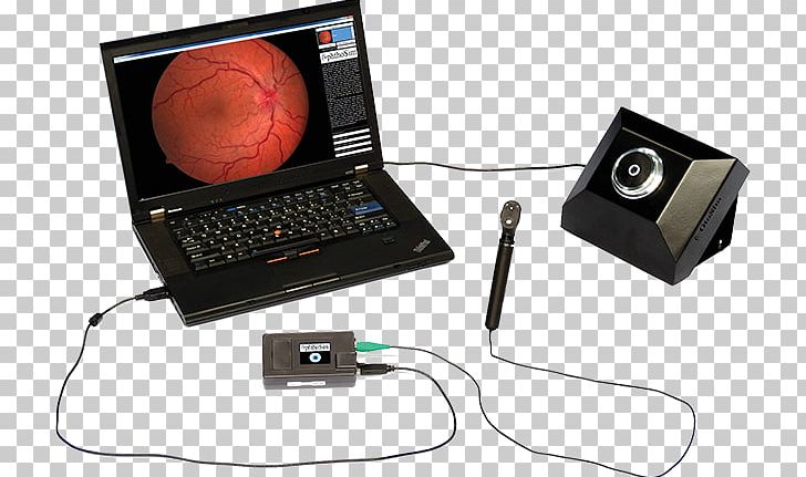 Ophthalmoscopy Simulation Virtual Reality Simulator Virtuality PNG, Clipart, Communication, Echocardiography, Electronic Device, Electronics, Electronics Accessory Free PNG Download