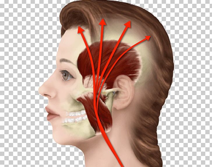 Myofascial Pain Syndrome Neck Pain Orofacial Pain Headache Face PNG, Clipart, Ache, Cheek, Chin, Chiropractic, Chronic Pain Free PNG Download