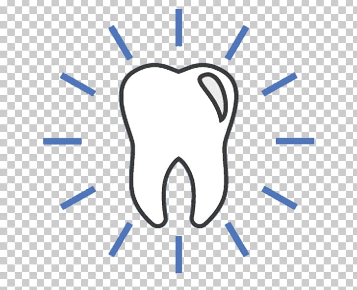Dentistry Orthodontics Dental Implant Dentures PNG, Clipart, Angle, Area, Blue, Blue Star Dental Group, Brand Free PNG Download