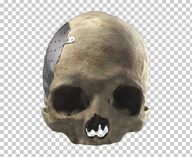 Cranioplasty Poly Skull Snout Skeleton PNG, Clipart, Bone, Business, Computer Software, Cranioplasty, Engineer Free PNG Download